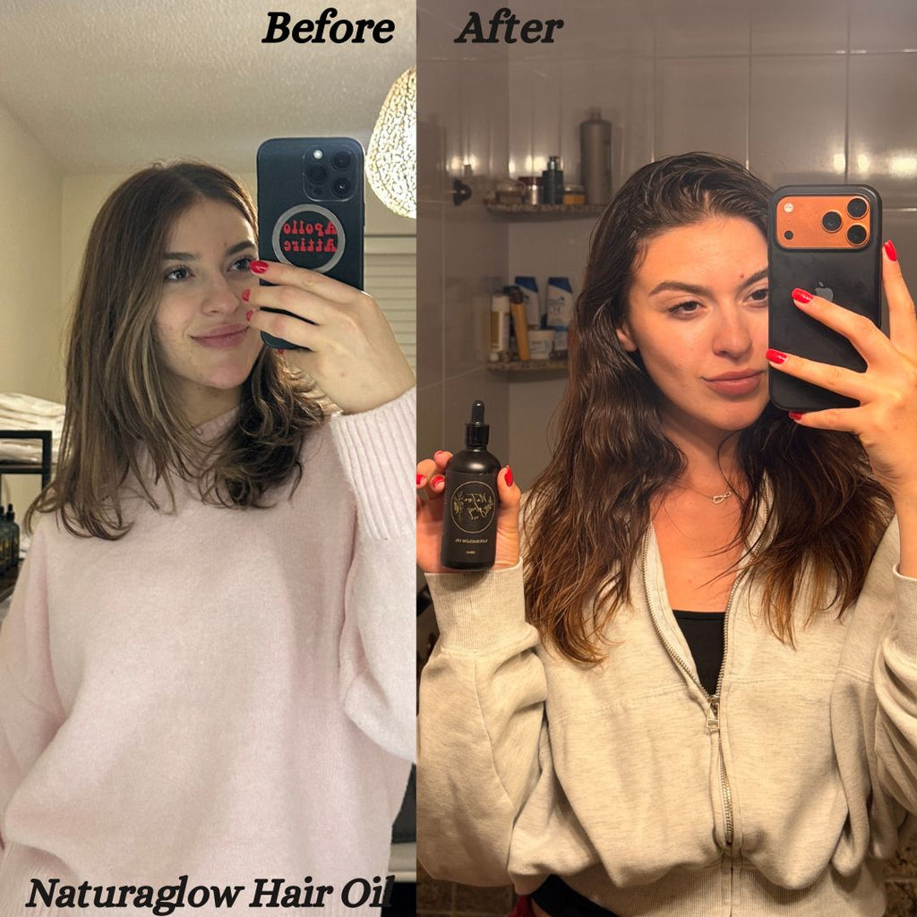 Naturaglow Hair Growth Oil