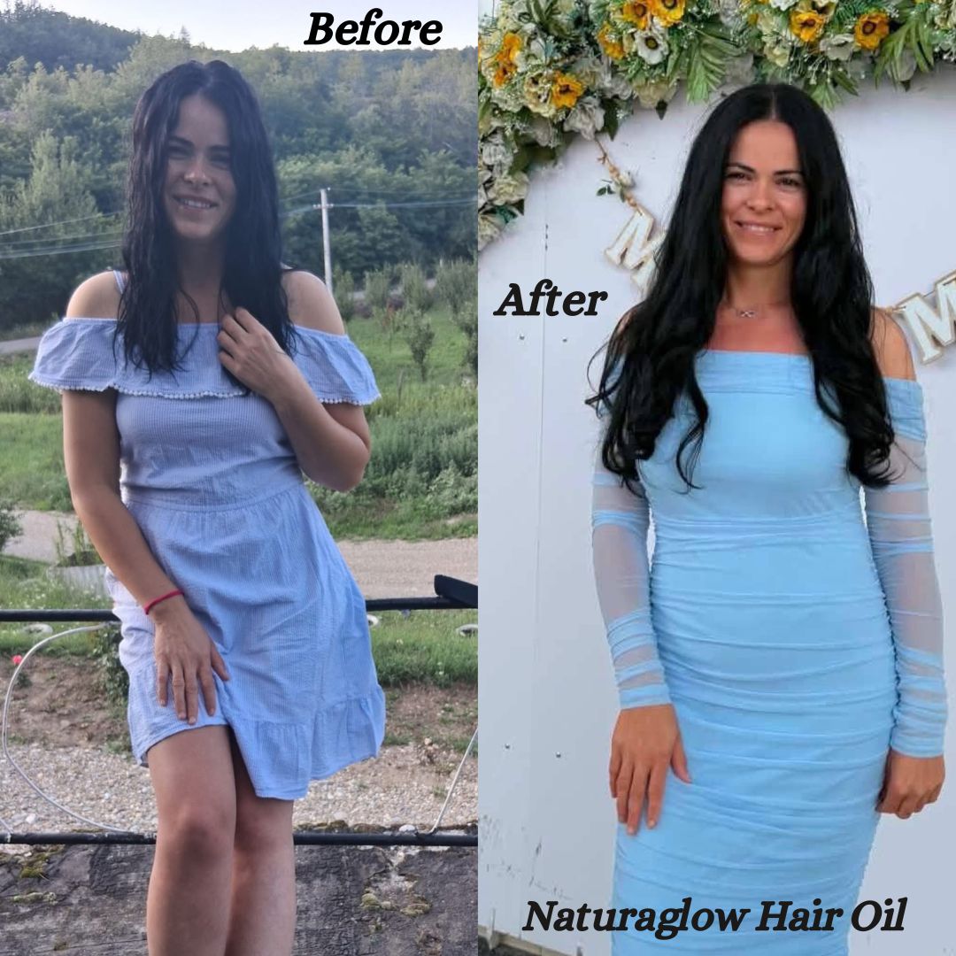 Naturaglow Hair Growth Oil